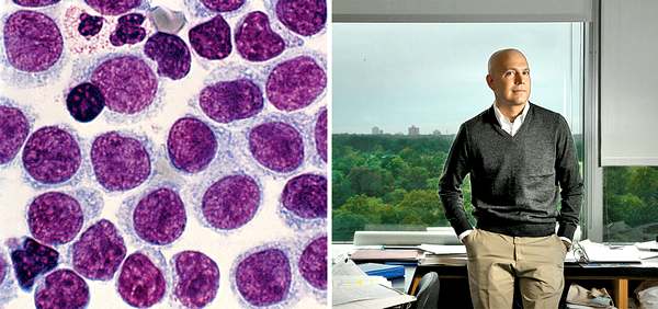 Слева: Препарат клеток крови пациента с волосатоклеточным лейкозом. Это довольно редкое заболевание (около 2% от всех лейкозов), поражает в основном мужчин старше 50 лет. Химиотерапия дает хороший результат: у 95% пациентов удается достичь многолетней ремиссии  Справа: Молекулярный биолог Лукас Уортман в своем кабинете в Университете Вашингтона в Сент-Луисе 22 сентября 2011 года. До наступления ремиссии он боролся с лейкозом 1 девять лет. Фото: SPL/EAST NEWS